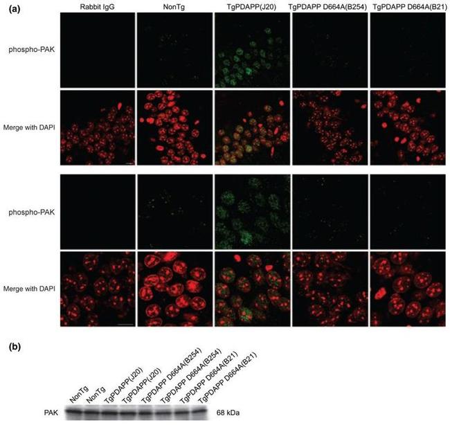 Phospho-PAK1/2/3 (Ser141) Antibody in Immunocytochemistry (ICC/IF)