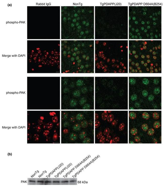 Phospho-PAK1/2/3 (Ser141) Antibody in Immunocytochemistry (ICC/IF)