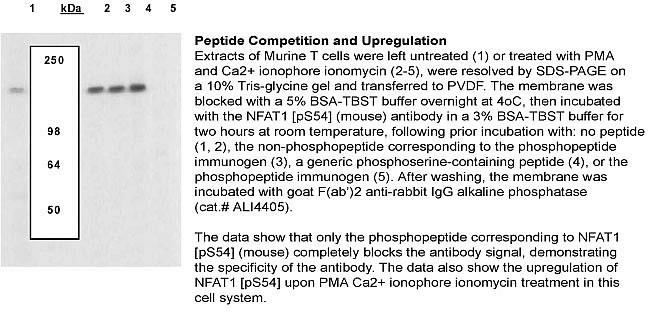 Phospho-NFATC2 (Ser54) Antibody in Western Blot (WB)