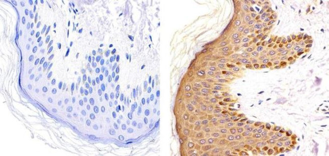 Phospho-PKC gamma (Thr514) Antibody in Immunohistochemistry (Paraffin) (IHC (P))