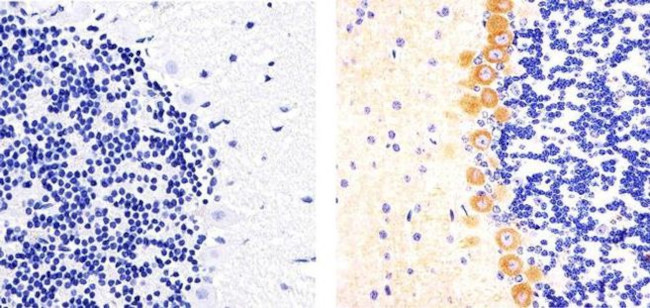 Phospho-PKC gamma (Thr514) Antibody in Immunohistochemistry (Paraffin) (IHC (P))