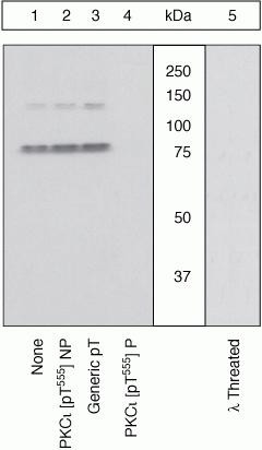 Phospho-PKC lambda/iota (Thr557, Thr564) Antibody in Western Blot (WB)