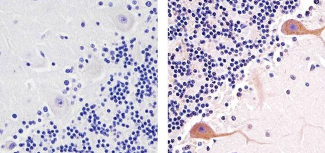 Phospho-PKC gamma (Thr674) Antibody in Immunohistochemistry (Paraffin) (IHC (P))