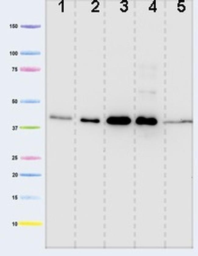 PDHA1 Antibody in Western Blot (WB)