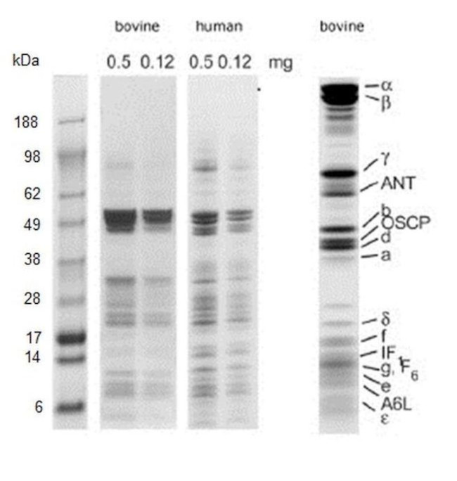 ATP5A1 Antibody in Immunoprecipitation (IP)