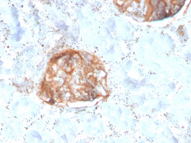 MTAP Antibody in Immunohistochemistry (Paraffin) (IHC (P))