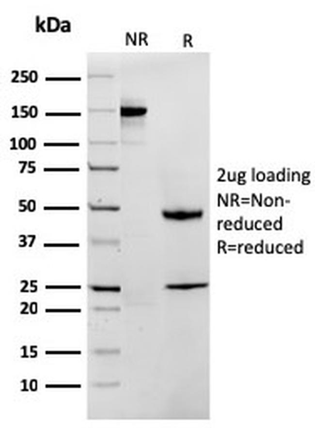 MTAP Antibody in SDS-PAGE (SDS-PAGE)