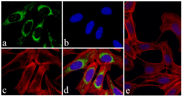 AIF Antibody in Immunocytochemistry (ICC/IF)