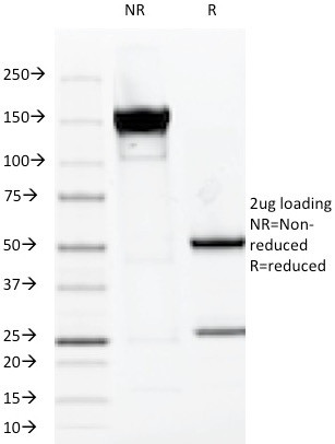 MUC1/CA15-3/EMA/CD227 (Epithelial Marker) Antibody in SDS-PAGE (SDS-PAGE)