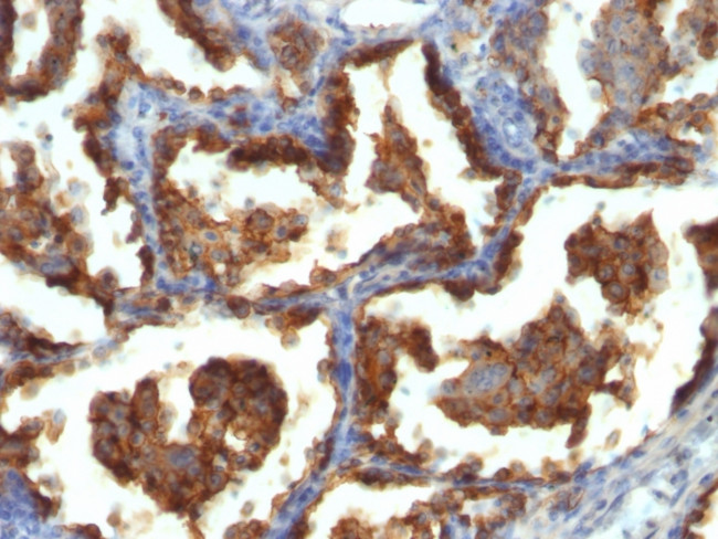 MUC1/CA15-3/EMA/CD227 (Epithelial Marker) Antibody in Immunohistochemistry (Paraffin) (IHC (P))