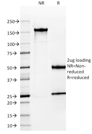 MUC1/CA15-3/EMA/CD227 (Epithelial Marker) Antibody in SDS-PAGE (SDS-PAGE)