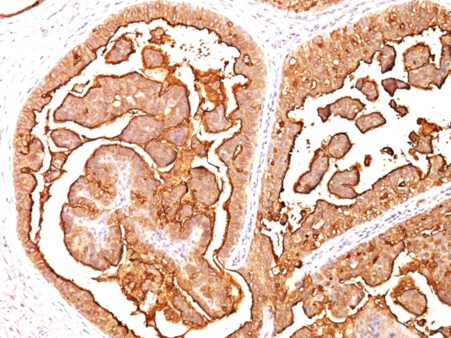 MUC1/CA15-3/EMA/CD227 (Epithelial Marker) Antibody in Immunohistochemistry (Paraffin) (IHC (P))