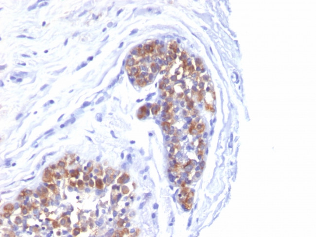 MUC1/CA15-3/EMA/CD227 (Epithelial Marker) Antibody in Immunohistochemistry (Paraffin) (IHC (P))