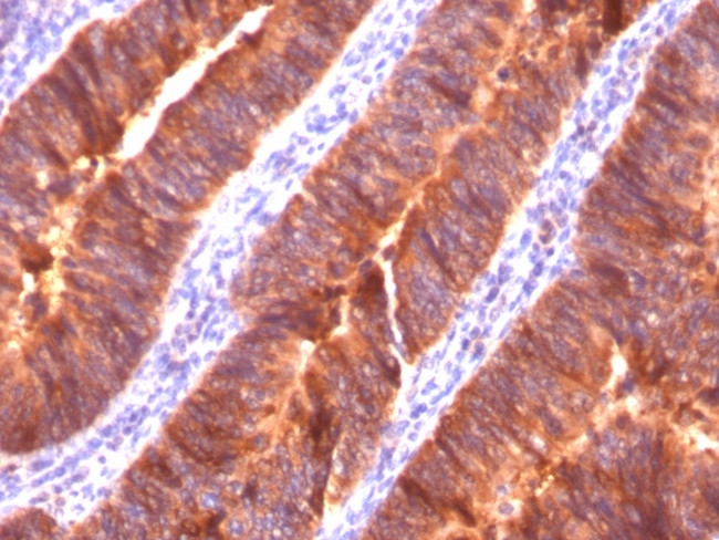 MUC1/CA15-3/EMA/CD227 (Epithelial Marker) Antibody in Immunohistochemistry (Paraffin) (IHC (P))