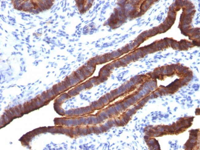 MUC1/CA15-3/EMA/CD227 (Epithelial Marker) Antibody in Immunohistochemistry (Paraffin) (IHC (P))