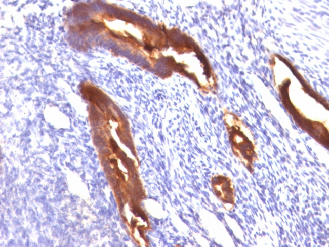 MUC1/CA15-3/EMA/CD227 (Epithelial Marker) Antibody in Immunohistochemistry (Paraffin) (IHC (P))