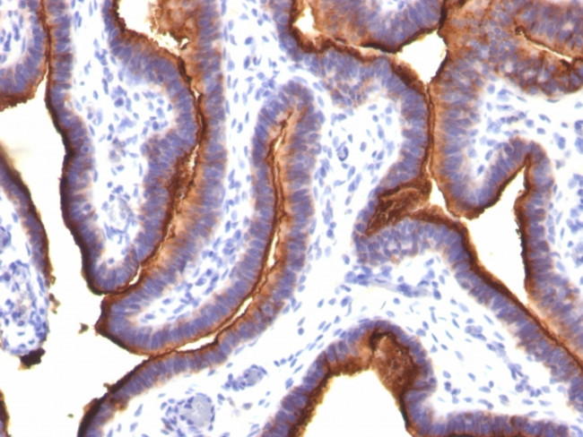 MUC1/CA15-3/EMA/CD227 (Epithelial Marker) Antibody in Immunohistochemistry (Paraffin) (IHC (P))