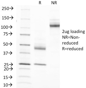 MUC1/CA15-3/EMA/CD227 (Epithelial Marker) Antibody in SDS-PAGE (SDS-PAGE)