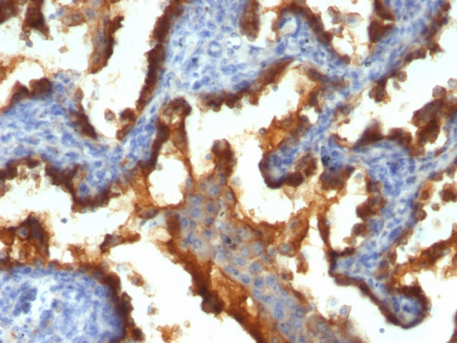 MUC1/CA15-3/EMA/CD227 (Epithelial Marker) Antibody in Immunohistochemistry (Paraffin) (IHC (P))