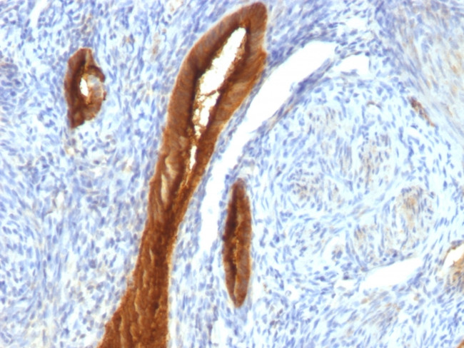 MUC1/CA15-3/EMA/CD227 (Epithelial Marker) Antibody in Immunohistochemistry (Paraffin) (IHC (P))