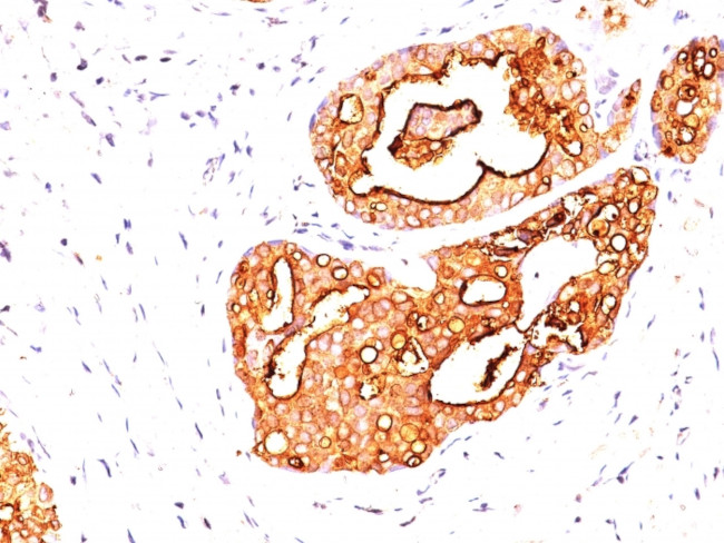 MUC1/CA15-3/EMA/CD227 (Epithelial Marker) Antibody in Immunohistochemistry (Paraffin) (IHC (P))