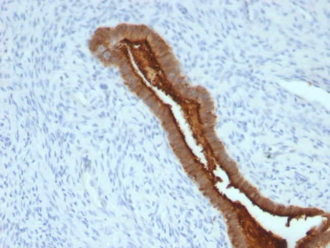 MUC1/CA15-3/EMA/CD227 (Epithelial Marker) Antibody in Immunohistochemistry (Paraffin) (IHC (P))