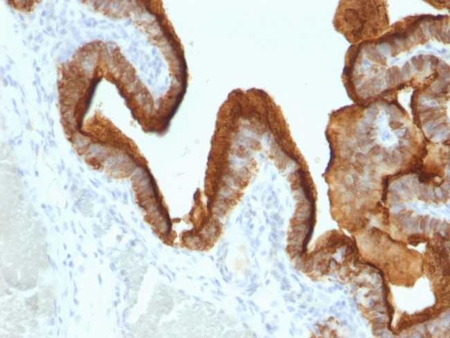 MUC1/CA15-3/EMA/CD227 (Epithelial Marker) Antibody in Immunohistochemistry (Paraffin) (IHC (P))