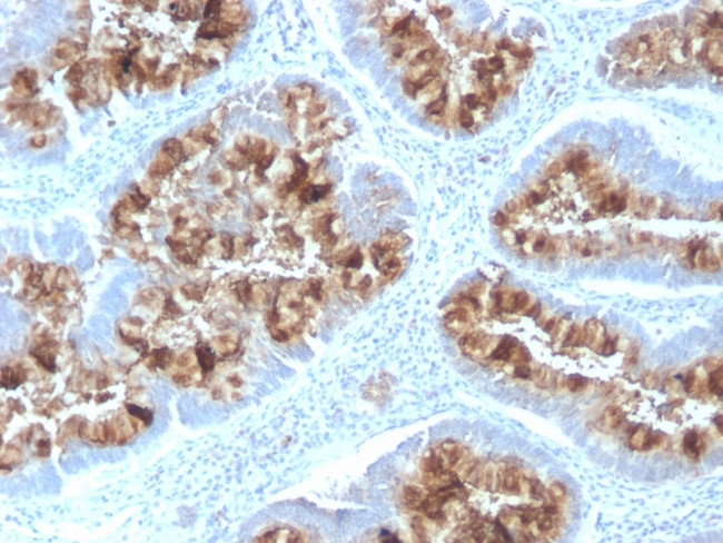 MUC1/CA15-3/EMA/CD227 Antibody in Immunohistochemistry (Paraffin) (IHC (P))