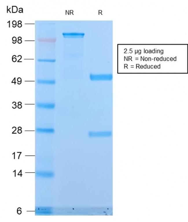 MUC1/CA15-3/EMA/CD227 Antibody in SDS-PAGE (SDS-PAGE)