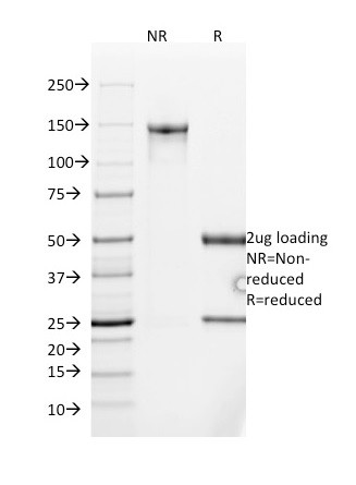 MUC2 (Mucin 2) Antibody in SDS-PAGE (SDS-PAGE)