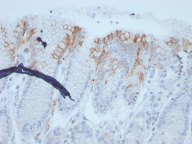 MUC2 (Mucin 2) Antibody in Immunohistochemistry (Paraffin) (IHC (P))