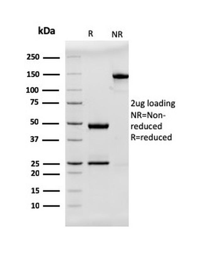 MUC2 (Mucin 2) Antibody in SDS-PAGE (SDS-PAGE)