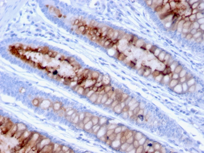 MUC4 (Mucin 4/Gastric Mucin) Antibody in Immunohistochemistry (Paraffin) (IHC (P))