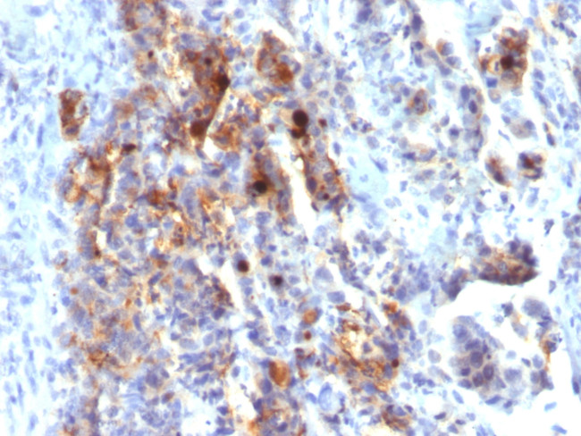 MUC5AC (Mucin 5AC/Gastric Mucin) Antibody in Immunohistochemistry (Paraffin) (IHC (P))