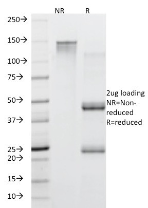 MUC5AC (Mucin 5AC/Gastric Mucin) Antibody in SDS-PAGE (SDS-PAGE)