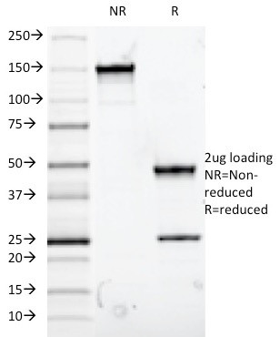 MUC5AC (Mucin 5AC/Gastric Mucin) Antibody in SDS-PAGE (SDS-PAGE)