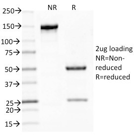 MUC5AC (Mucin 5AC/Gastric Mucin) Antibody in SDS-PAGE (SDS-PAGE)