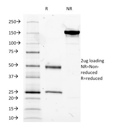 MUC5AC (Mucin 5AC/Gastric Mucin) Antibody in SDS-PAGE (SDS-PAGE)