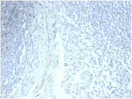 MUC5AC (Mucin 5AC/Gastric Mucin) Antibody in Immunohistochemistry (Paraffin) (IHC (P))