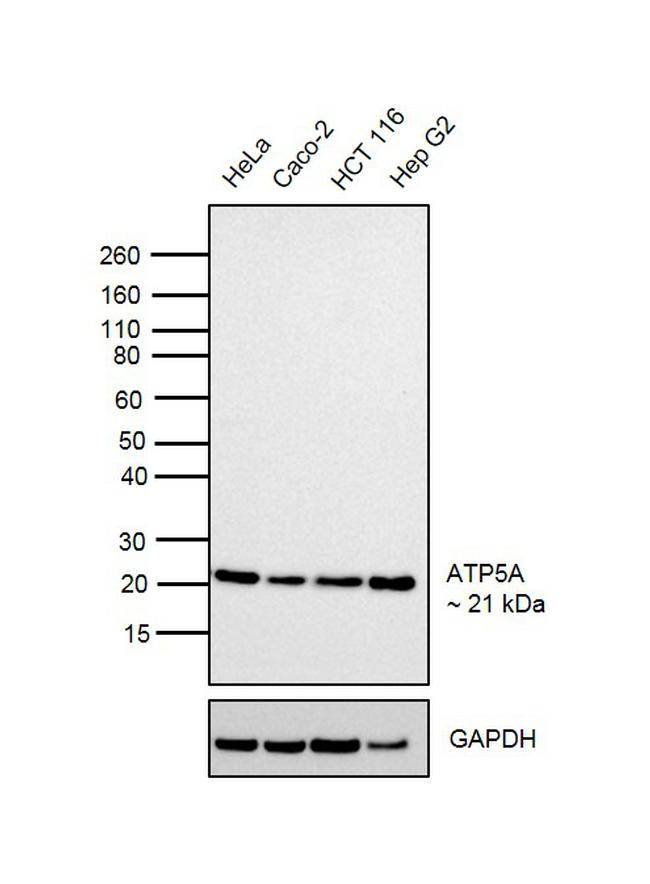 ATP5H Antibody in Western Blot (WB)