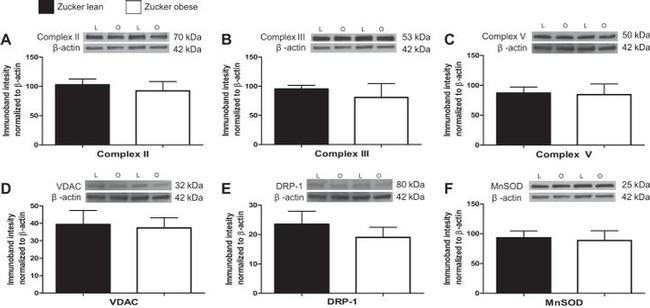 UQCRC1 Antibody in Western Blot (WB)