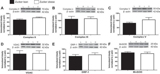 SDHA Antibody in Western Blot (WB)