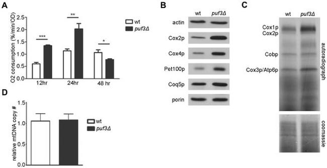 Porin Antibody in Western Blot (WB)