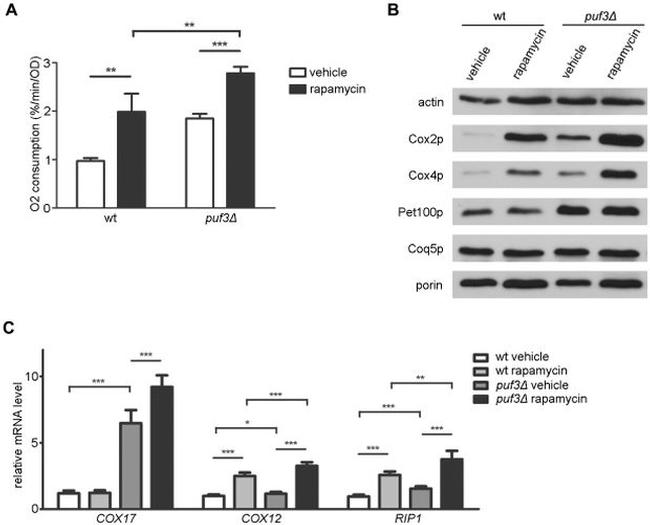 Porin Antibody in Western Blot (WB)