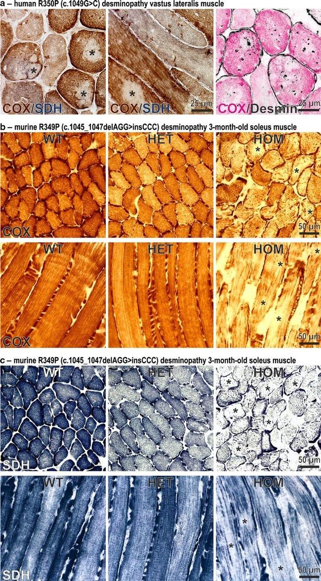 SDHA Antibody in Immunohistochemistry (IHC)