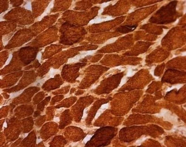 SDHA Antibody in Immunohistochemistry (Frozen) (IHC (F))