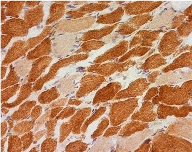 NDUFB8 Antibody in Immunohistochemistry (Frozen) (IHC (F))