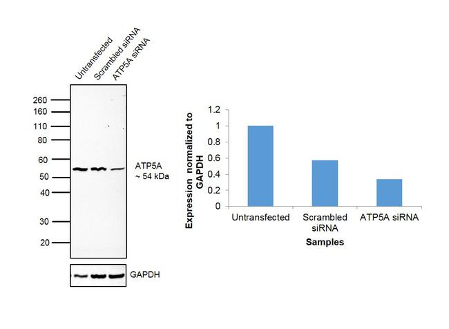 ATP5A1 Antibody in Western Blot (WB)