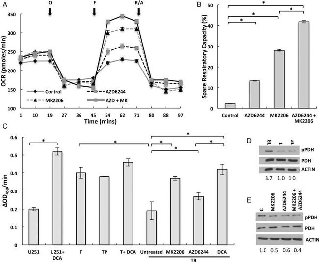 PDHA1 Antibody in Western Blot (WB)