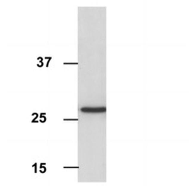 Porin Antibody in Western Blot (WB)